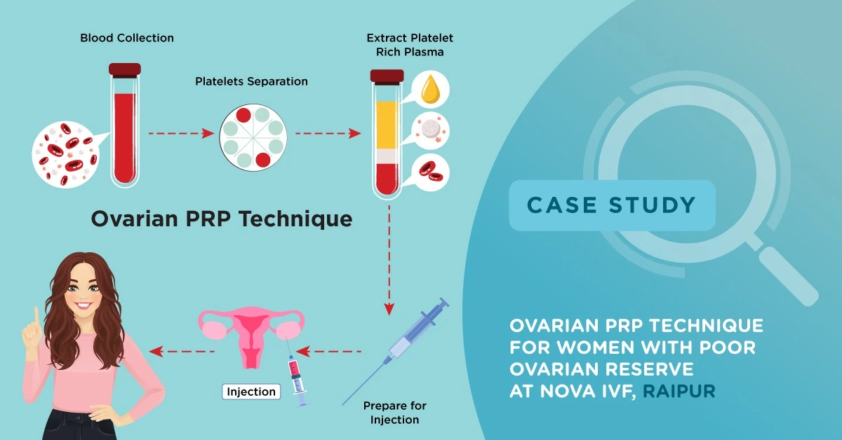 What Is Hyperspermia Symptoms Treatments And Causes Easy Guide Nova Ivf Fertility 2704